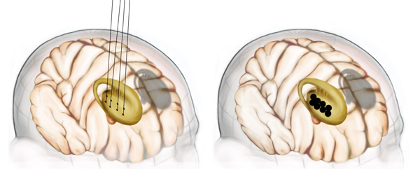 Medical Illustration